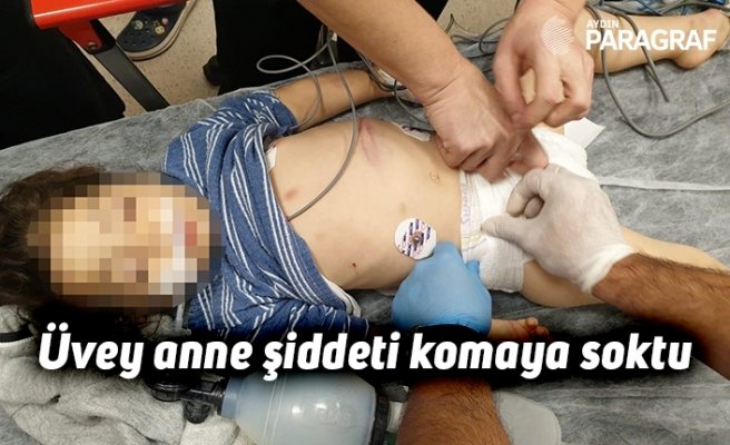 Üvey anne şiddeti komaya soktu